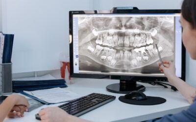 Can a Toothache Go Away on Its Own?