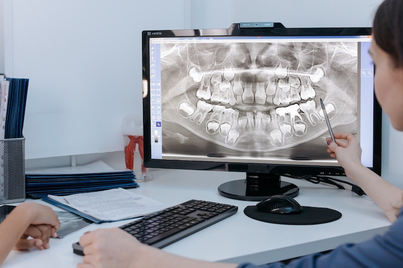 Can a Toothache Go Away on Its Own?